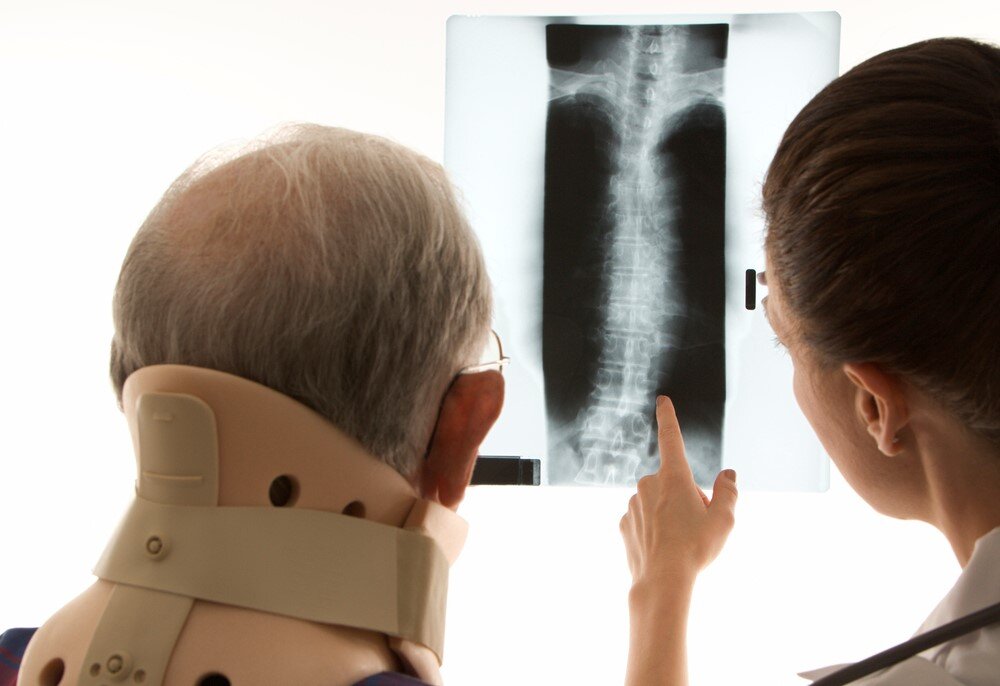 Patient With Neckbrace Looking At His Spine Xray Injuries